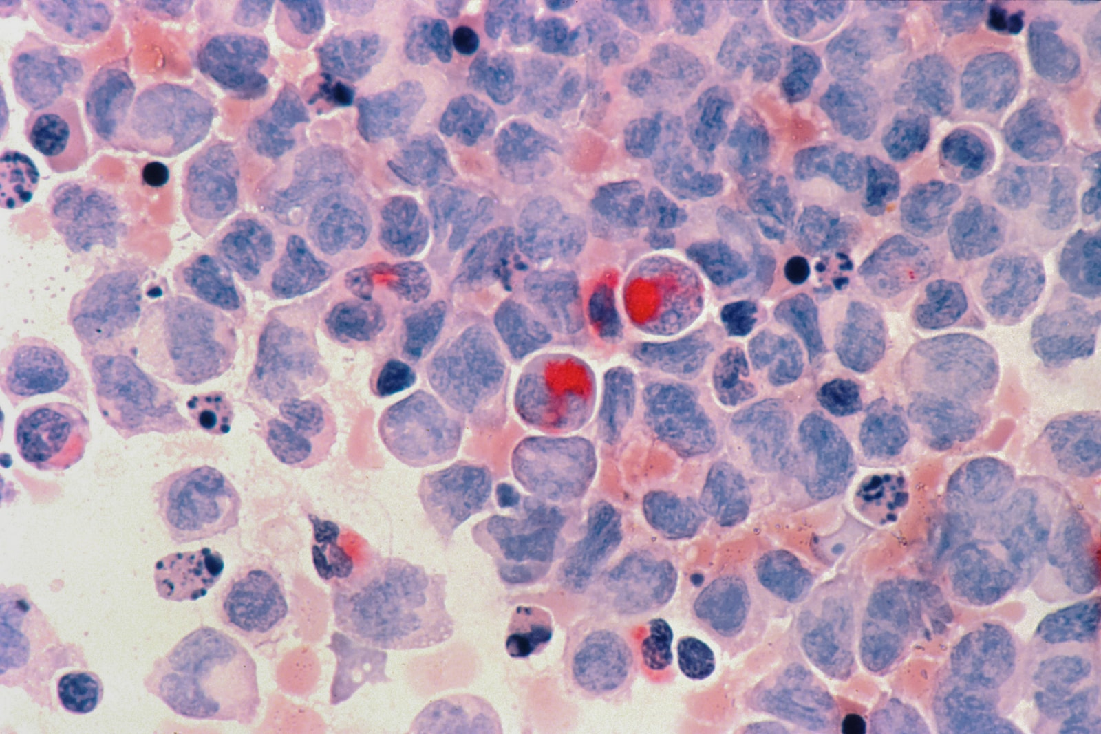 red round cells on white and blue surface